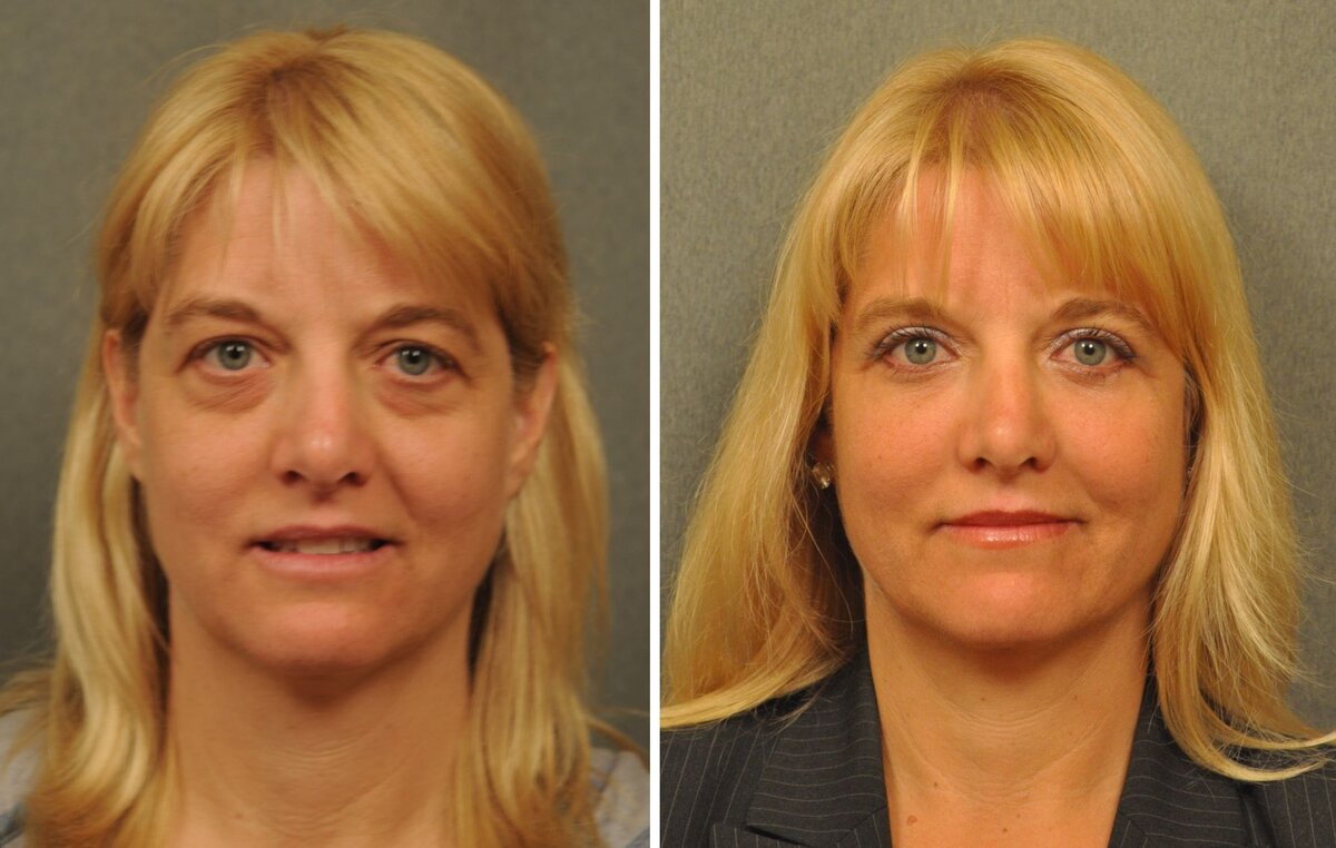 Источник: face-engineering-exercises.org