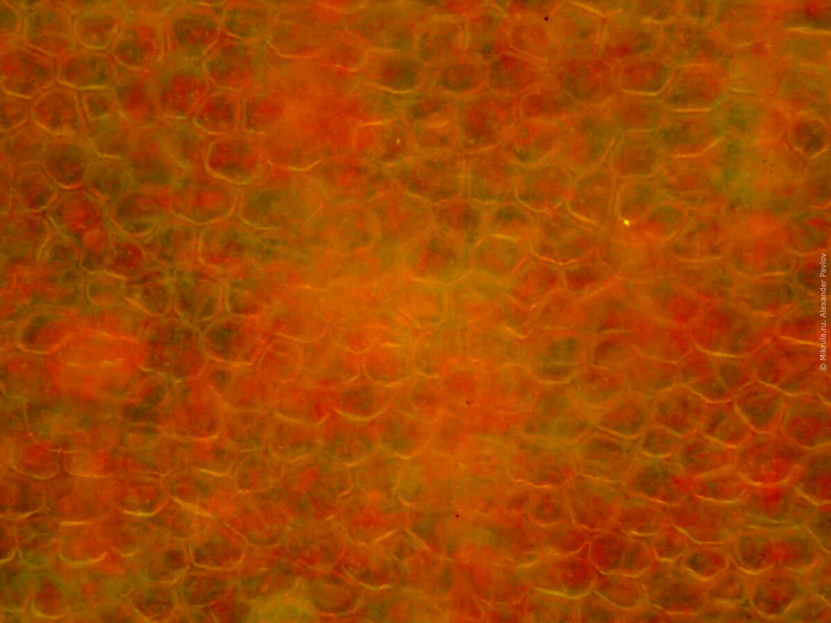 Клетка мякоти рябины. Клетки кожицы томата. Клетка кожицы томата под микроскопом. Клетки мякоти томата под микроскопом. Клетки кожицы помидора.