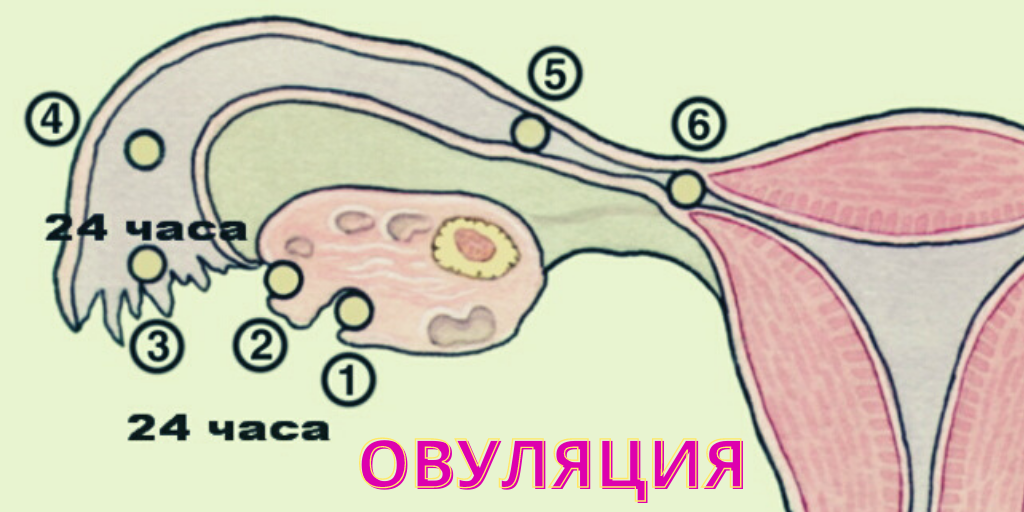 разрыв фолликула 