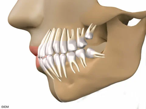 Источник: https://ozubkah.ru  
