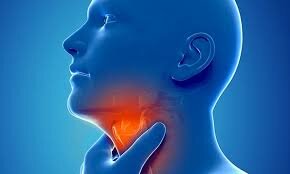 Воспаление горла не всегда вызвано бактериями или вирусами. Это может быть ожог кислотой!