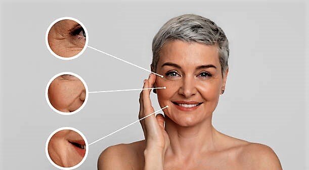 Виды морщин смеха. Фото с сайта unsplash.com