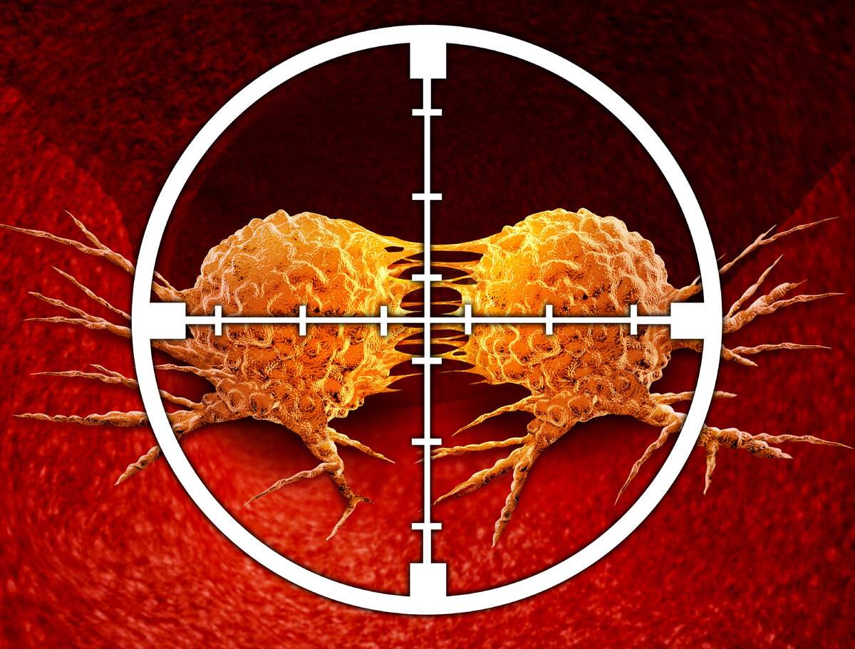 Что такое таргетная терапия и почему она стала прорывом в онкологии? |  Медицинская клиника «НАКФФ» | Дзен