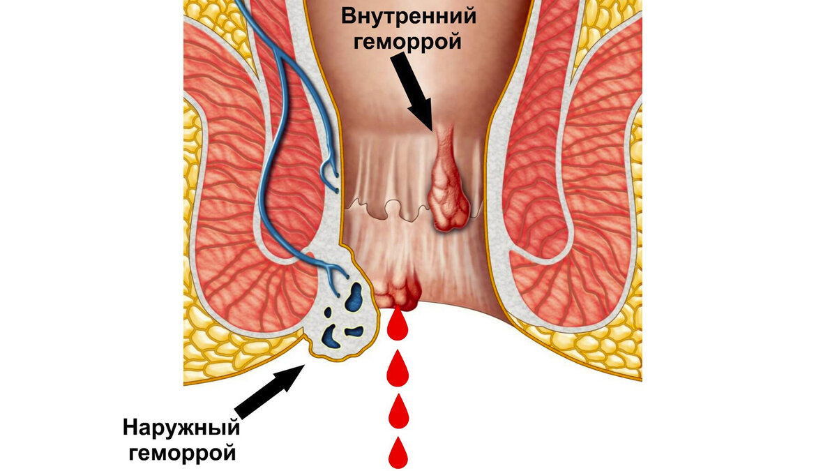 Источник фото - https://babyzzz.ru/