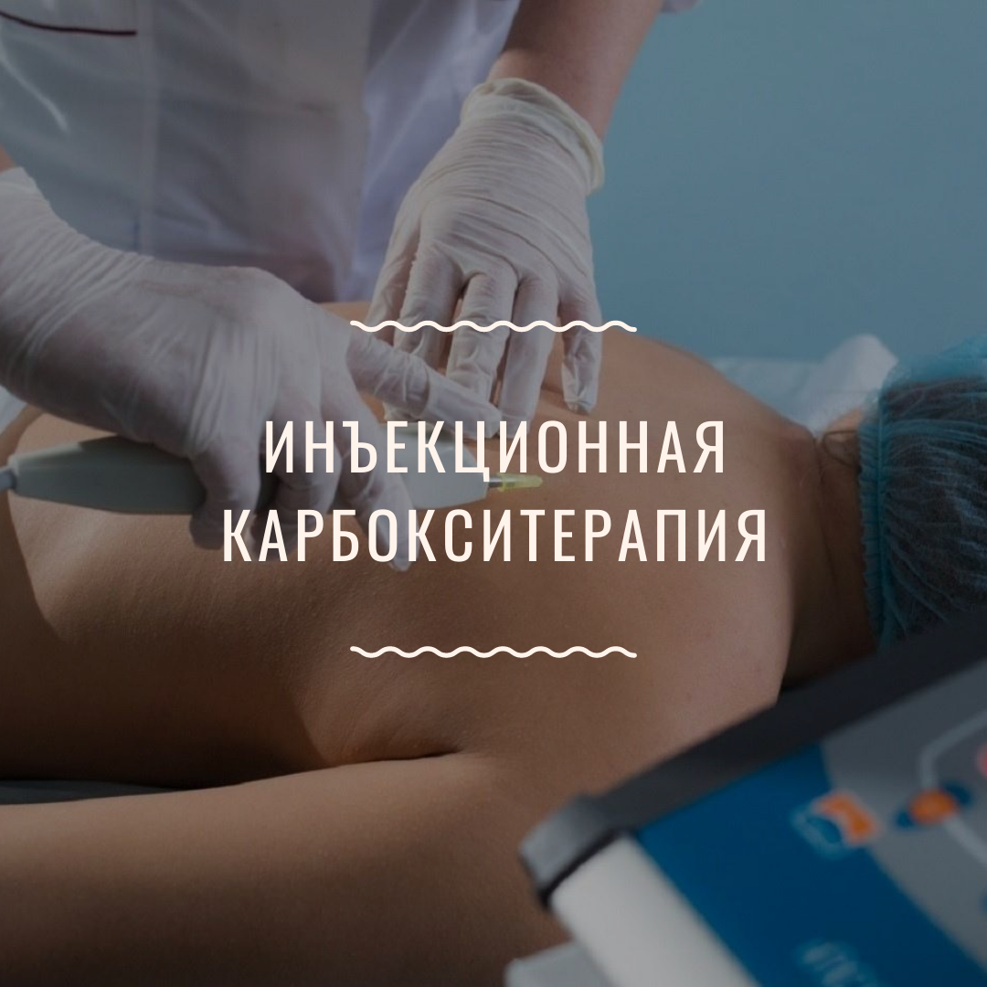 Карбокситерапия для суставов. Карбокситерапия инъекционная. Инъекционнач карбокси терапия. Карбокситерапия уколы в живот. Подкожное Введение углекислого газа карбокситерапия