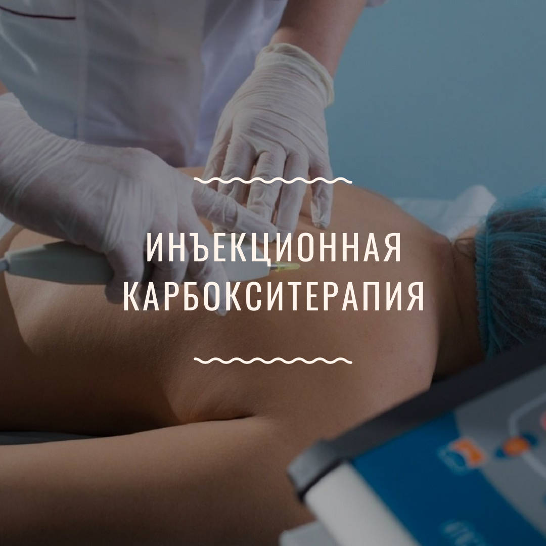 Карбокситерапия для суставов. Карбокситерапия инъекционная. Инъекционнач карбокси терапия. Карбокситерапия уколы в живот. Подкожное Введение углекислого газа карбокситерапия.