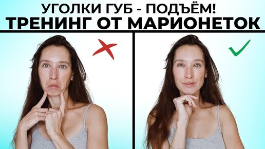 Опущенные уголки губ и морщины-марионетки - как убрать?