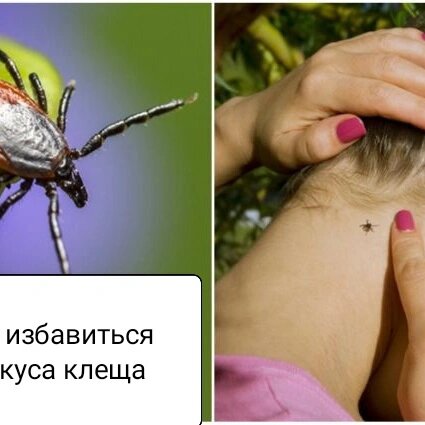 1) фото (носит познавательный характер)