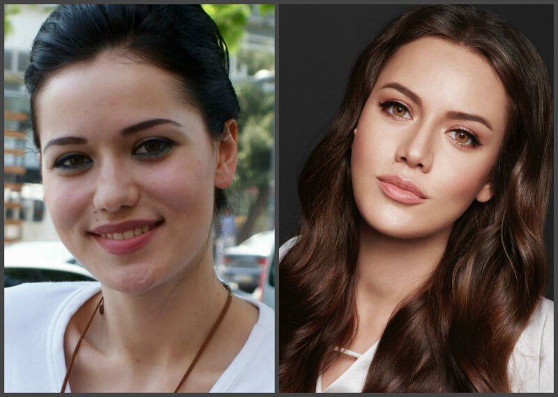 Звезды до и после пластических операций: 8 известных голливудских актрис