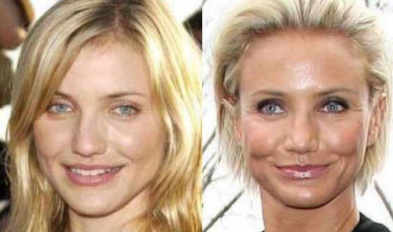 В переменах Кэмерон Диас виноваты гормоны
