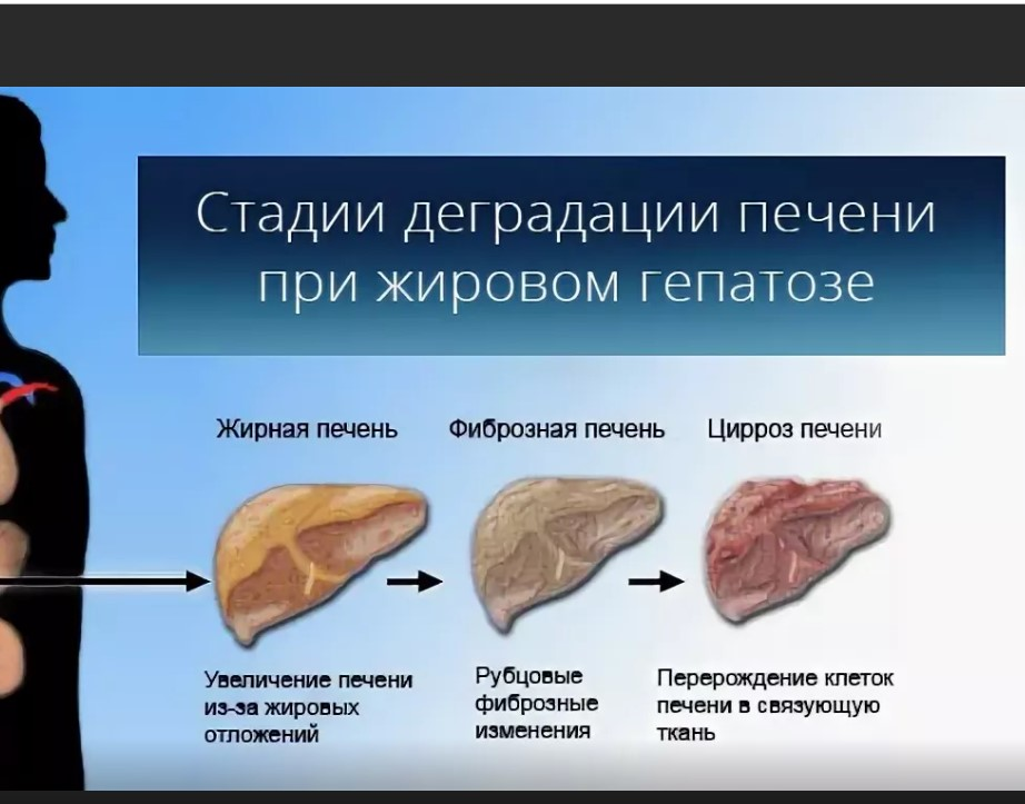Какая печень лучше