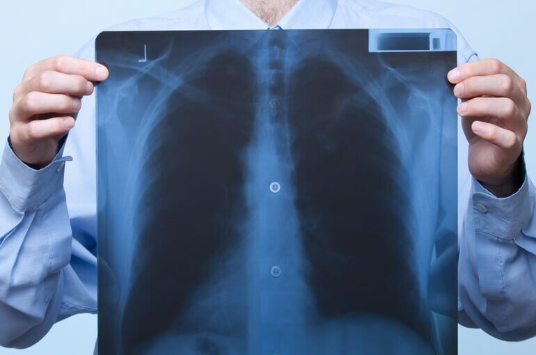 10 июль 2017   Руслан Слободянюк