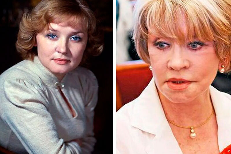 Звёзды, увлёкшиеся пластикой. Фото до и после