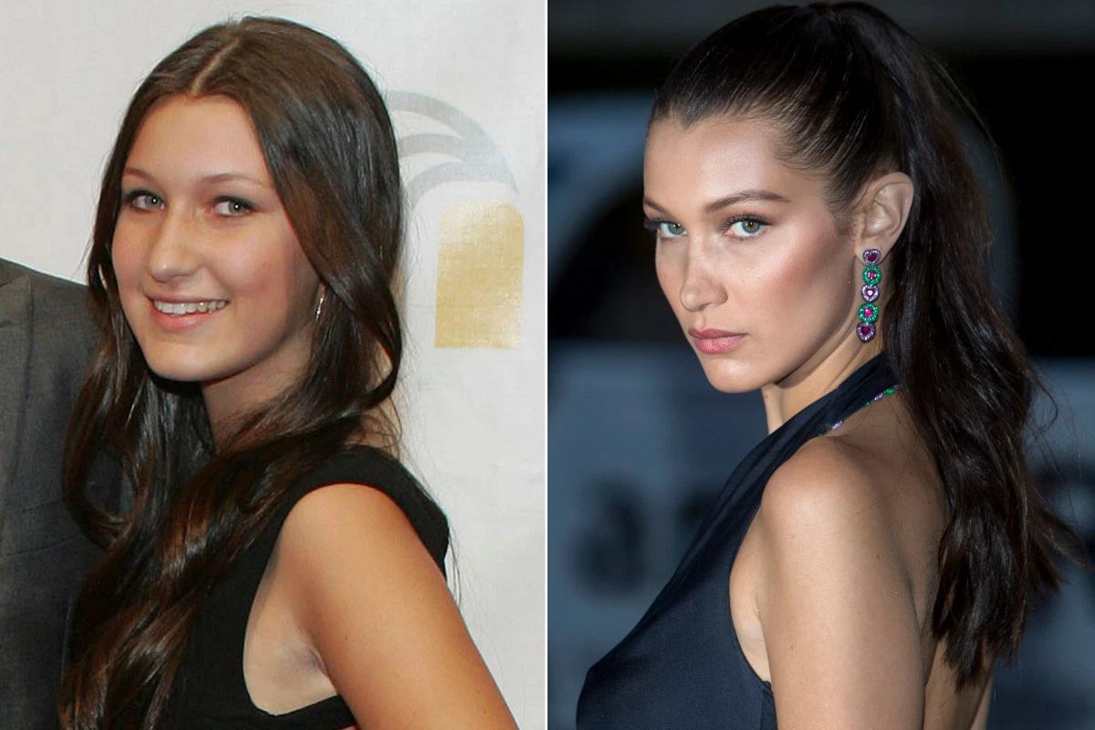 Белла Хадид до и после подтяжки бровей. Фото: hotallnews.net