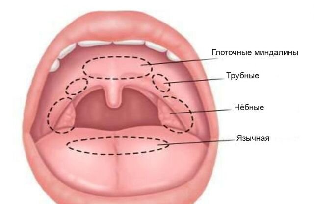 Хронический тонзиллит: симптомы и лечение