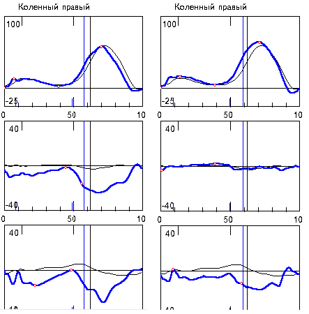 Картинки-скриншоты из программы. Тогда мониторы были совсем не плоские, оборудование какое дали, поэтому вся картинка на экран не влезала. 