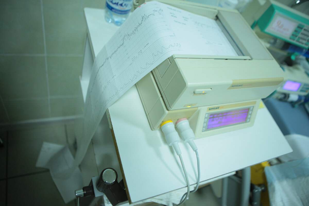 Кардиотокография (КТГ) является методом оценки состояния плода в родах путем регистрации частоты сердечных сокращений. Фото автора