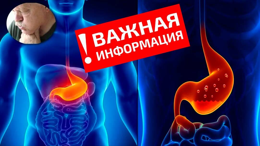 Почему болит желудок на овсянку?