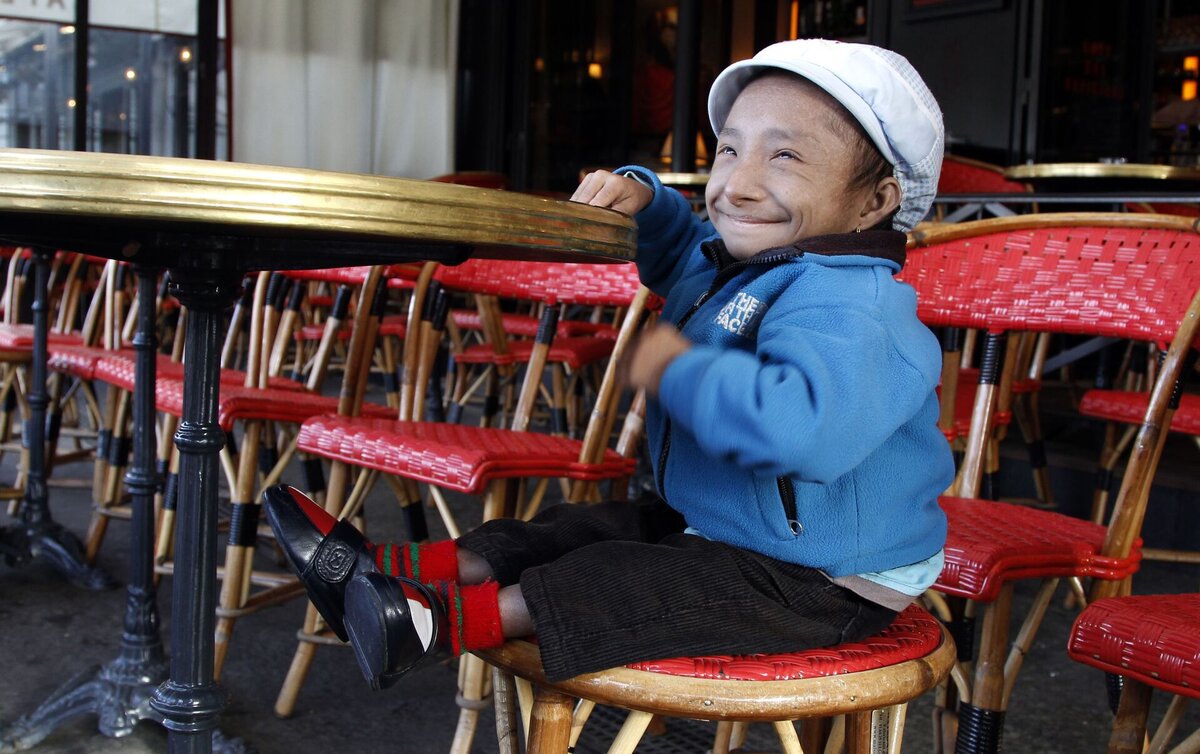 Хагендра тапа магар карлик. Хагендра тапа магар непал 67 см. Хагендра тапа магар фото. Хагендра тапа магар. Хагендра тапа магар могила.