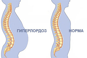 Сделайте вашей привычкой это простое движение, чтобы уменьшить боль в пояснице.