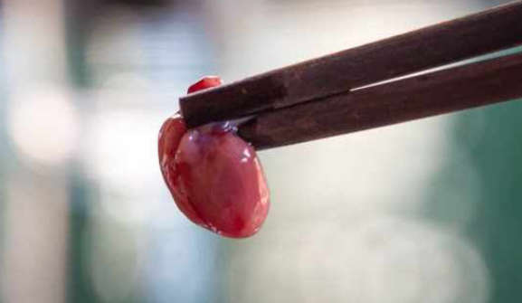 фото tektus.spb.ru