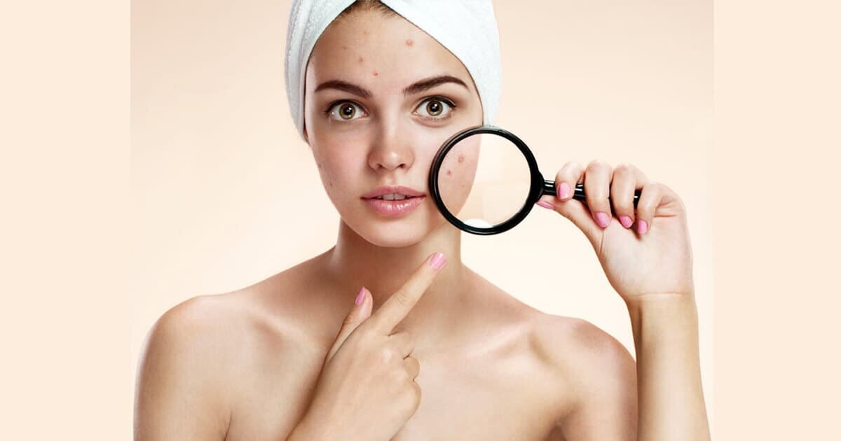 Источник:https://da-vita.ru/beauty-blog/kak-izbavitsya-ot-prishei-ugrei-na-litse.html