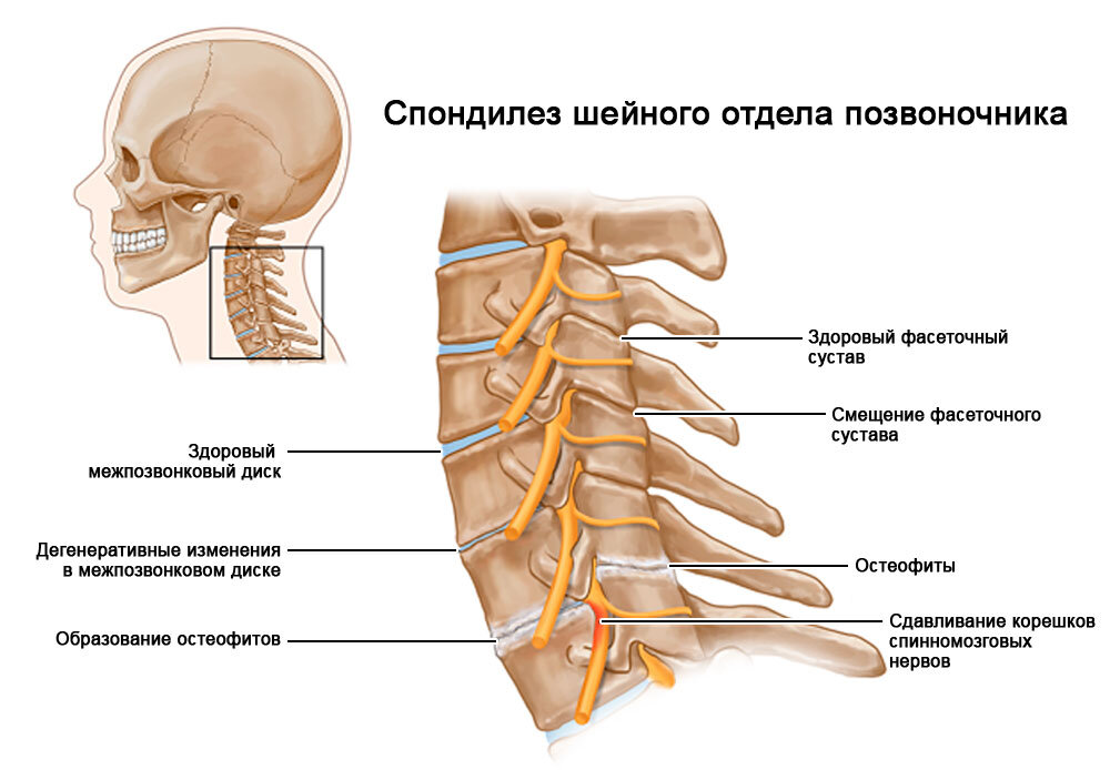 Болит шея с правой стороны: причины, симптомы, лечение и профилактика