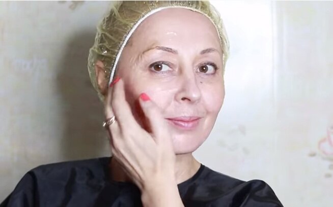 Морщины. Женщины. Красота. Молодость. Омоложение.