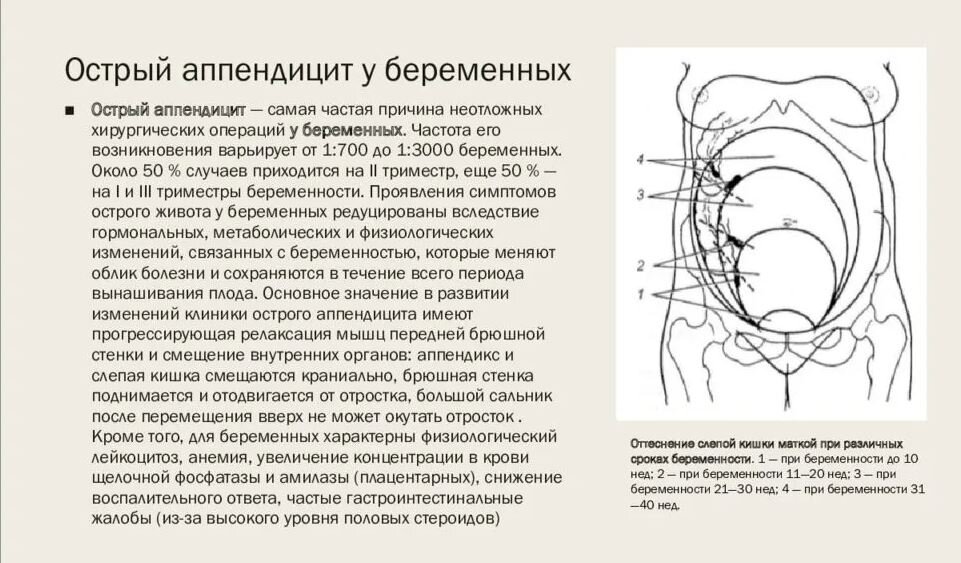 Болит низ живота справа при беременности