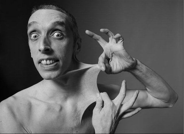 Самая эластичная кожа