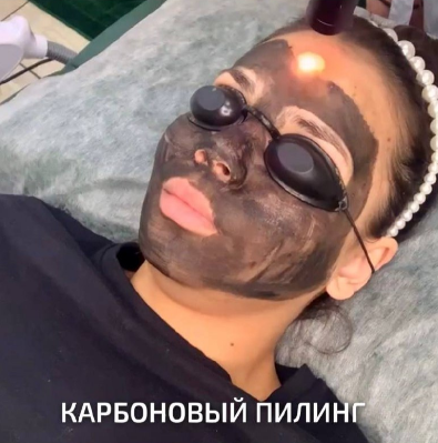 Процедура проведения карбонового пилинга специалистами студии "Forma"