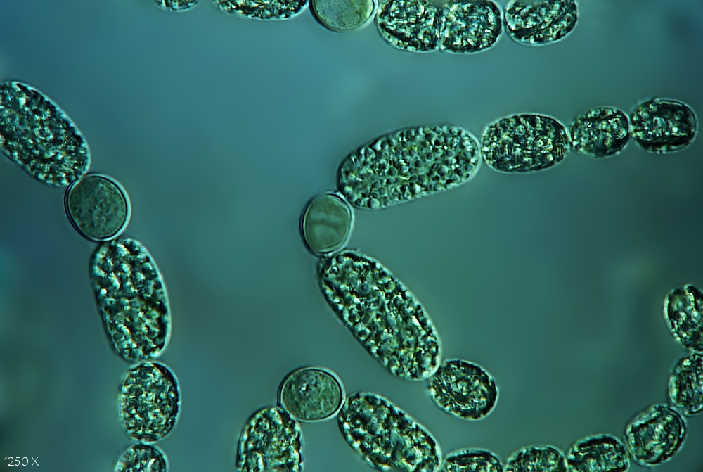 Клетки водорослей и цианобактерий. Цианобактерии Анабена. Цинобактерия анабапна. Цианобактерии носток Анабена. Анабена водоросли.