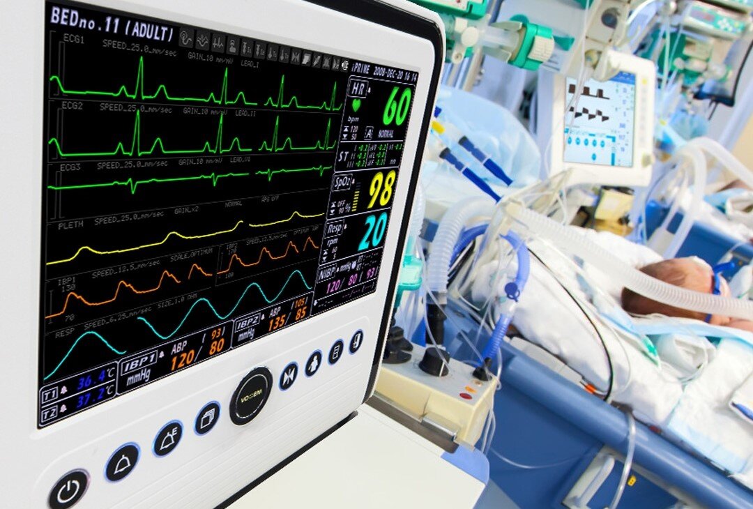 Мониторы пациента. Что важно знать? | Здоровье и Медицина | Дзен