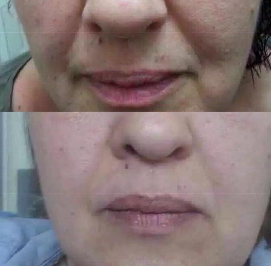  😏КОСМЕТИЧЕСКАЯ ЛИНИЯ LUMINESCE -ЛЮМИНЕЗ!!!!🤗

ПРЕВОСХОДНЫЙ РЕЗУЛЬТАТ ОТ JEUNESSE!!🤭

ТРИ НЕДЕЛИ ПРИМЕНЕНИЯ!!!👍

Утро: умывалка + сыворотка + дневной крем

Вечер: умывалка+ сыворотка + ночной крем

ПОДРОБНЕЕ НА ССЫЛКЕ👇👇👇
www.alliage.jeunesseglobal.com

#лифтинг #акне #чистаякожа #увлажнение #безпластики #безуколов #омоложение #подтяжкалица #сияющаякожа #молодаякожалица #упругаякожалица #сухаякожа #осветляющаякосметика #безпластики #безуколов