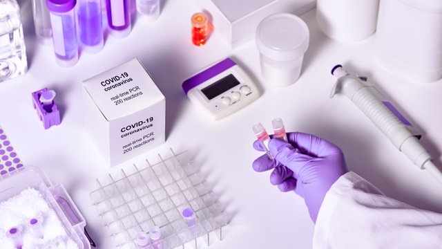 По всему миру не хватает тест-систем для выявления коронавируса.