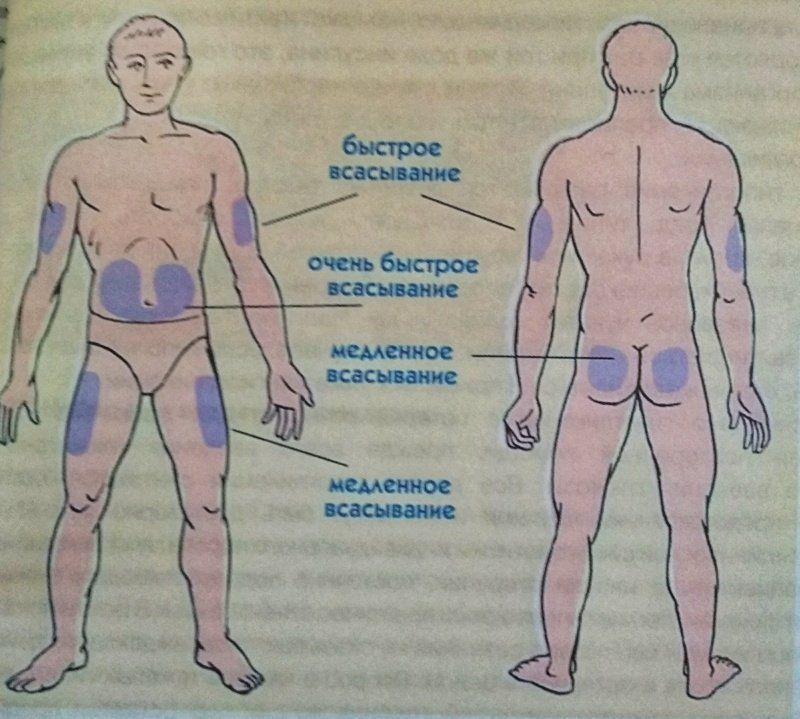 В каком месте сделать