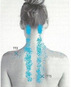 Зоны для проработки длинных разгибателей шеи