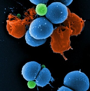 Сканирующая электронная микрофотография интактных (синих) и разрушенных PK150 (красных) клеток мультирезистентного золотистого стафилококка (MRSA) © Манфред Роде / HZI