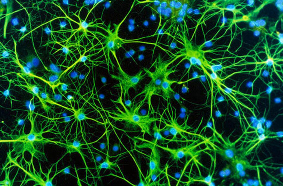 Астроциты. Фото: http://immunology.one/