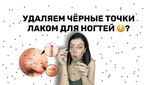 УДАЛИЛА ЧЁРНЫЕ ТОЧКИ ЛАКОМ ДЛЯ НОГТЕЙ ? Да ладно? Подпишись, у меня полезно!