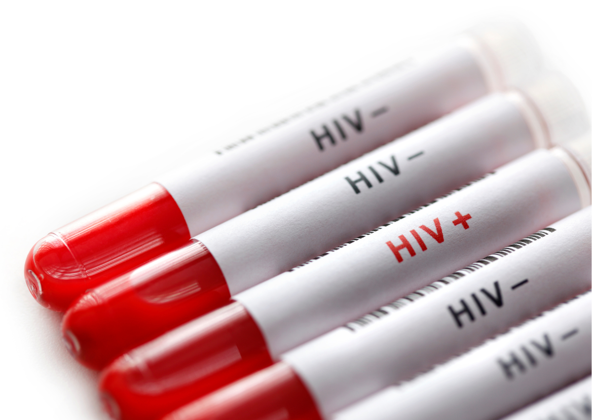ОИТС тест. HIV+. HIV+ что это значит.