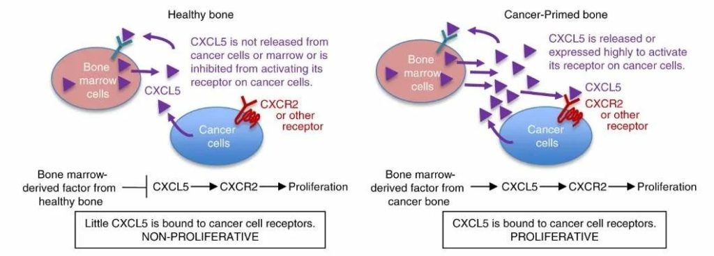 Модель CXCL5/CXCR2 при метастатической колонизации костей