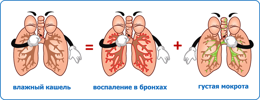 Как отличить кашель
