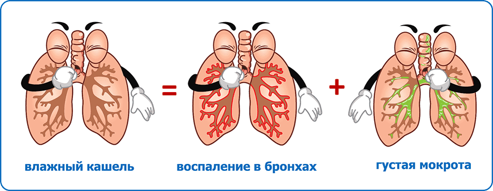 Кашель с незначительной мокротой. Влажный кашель. Легкие при Сухом кашле.