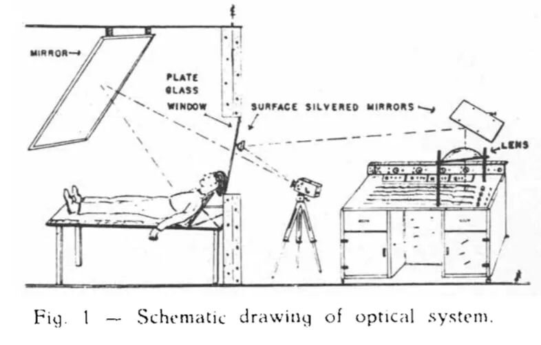Установка для ЭЭГ-видеомониторинга