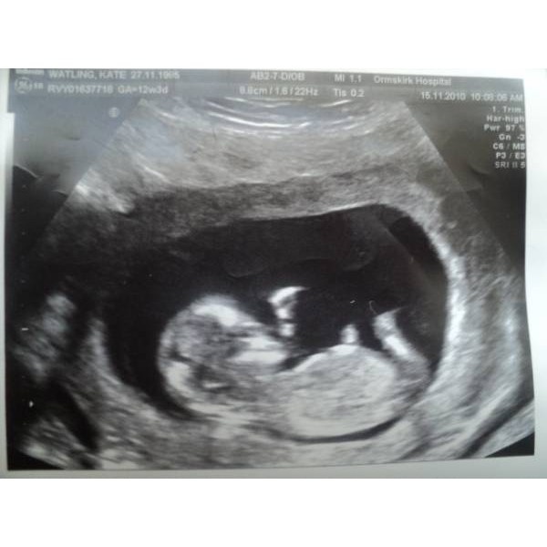 12недель счастья