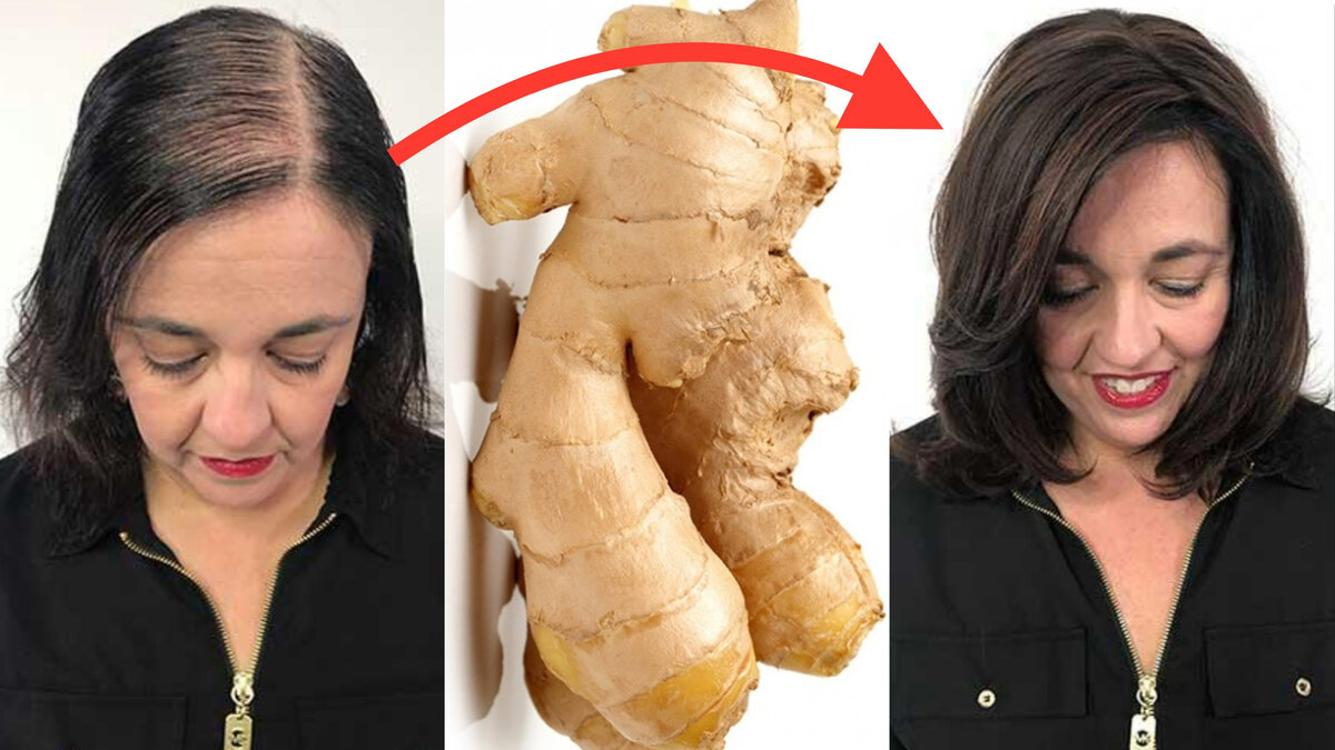 #лечениеволос #какотраститьволосы #выпадениеволос #облысение #уходзаволосами #маскадляроставолос #дляроставолос #алопеция 