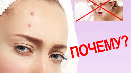 Почему нельзя давить прыщи в треугольнике. Почему нельзя давить прыщи в треугольнике. Прыщи на носогубном треугольнике причины. Почему нельзя давить прыщи в треугольнике. Прыщи в носогубном треугольнике.