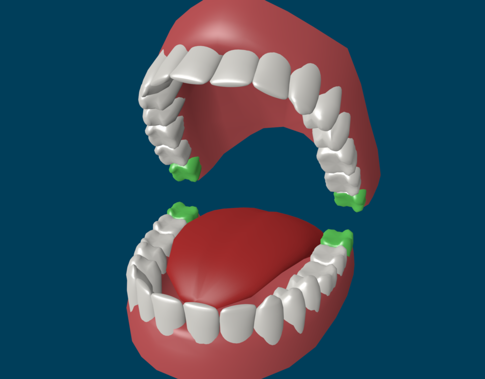  До 16 лет у большинства людей челюстной ряд считается сформированным. Но есть еще зуб мудрости у человека, который начинает свой рост с этого времени, доставляя массу неприятных ощущений.-2