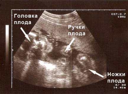 Источник: https://moydiagnos.ru